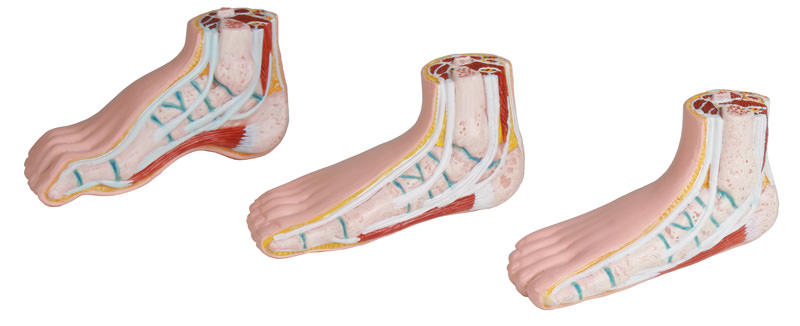 Reproduction of Normal foot – Medstore